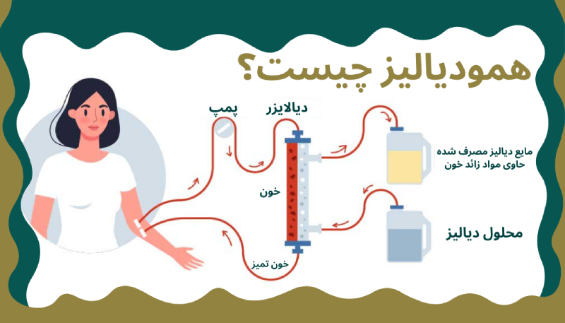 همودیالیز