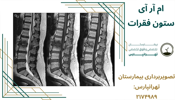 ام آر آی ستون فقرات