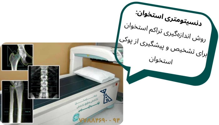 دنسیتومتری استخوان بیمارستان تهرانپارس