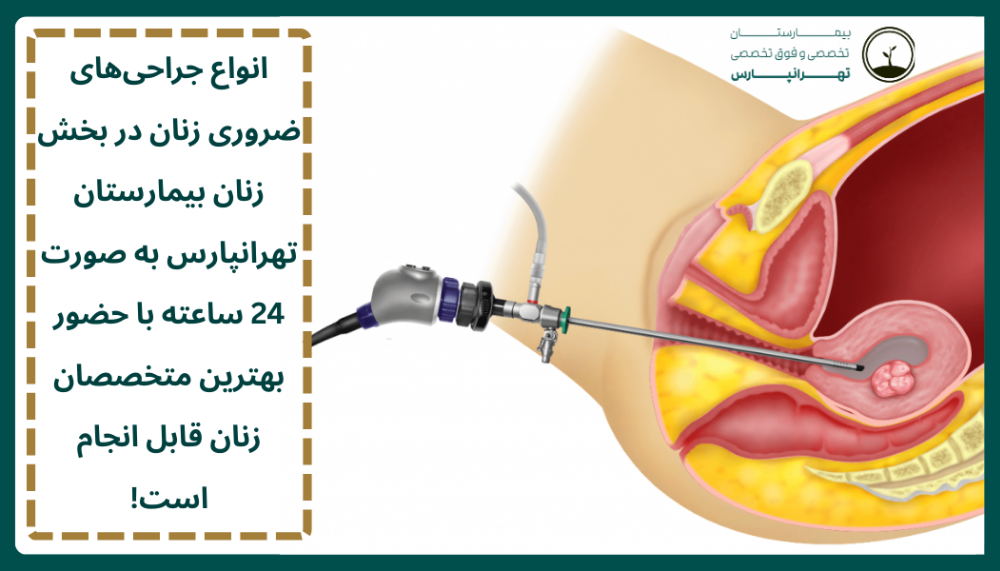 جراحی های زنان در بیمارستان تهرانپارس