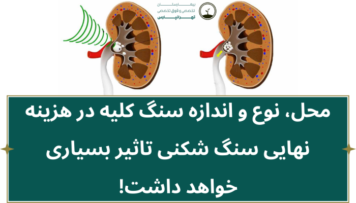 هزینه سنگ شکن کلیه