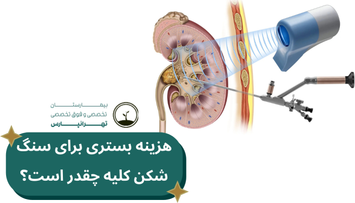 هزینه بستری سنگشکنی کلیه