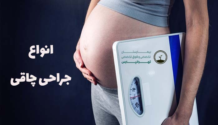 انواع جراحی چاقی - بارداری بعد از آن