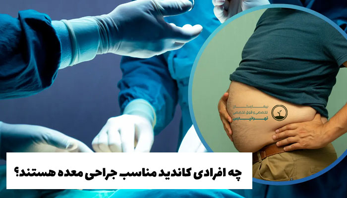  کاندیدای مناسب جراحی معده برای چاقی 