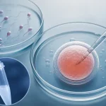 گرفتن اسپرم تخمک برای ای وی اف در مرکز درمان ناباروری